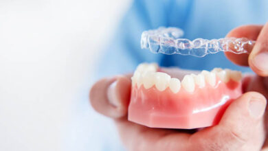 How to Choose Invisalign Providers Everything You Need to Know