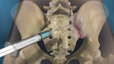 SI Joint Injection What You Need to Know